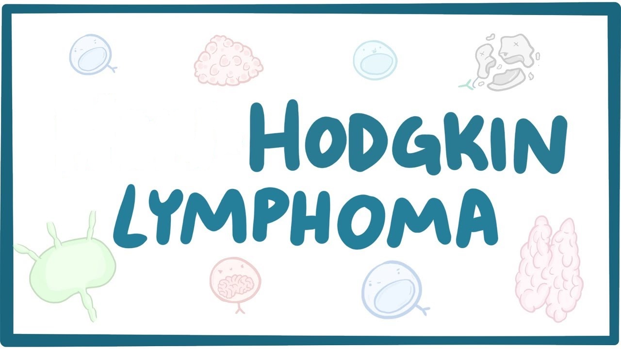 A small change makes a big difference in Hodgkin lymphoma